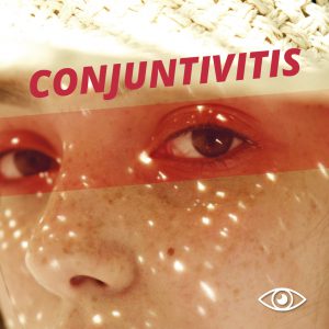 Imagen de la cabecera del post de conjuntivitis